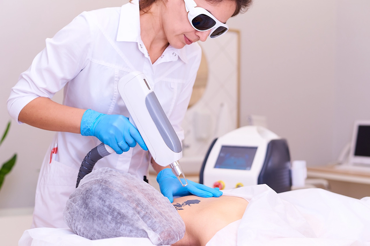 أخصائية تجميل تستخدم جهاز ليزر لإزالة وشم من ظهر مريض في مركز تجميل في الشارقة