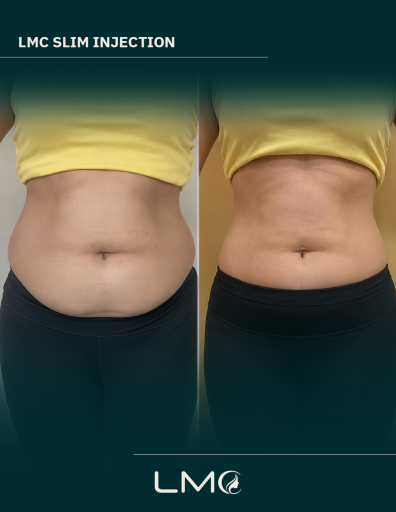 weight-loss-dubai-before-after-3