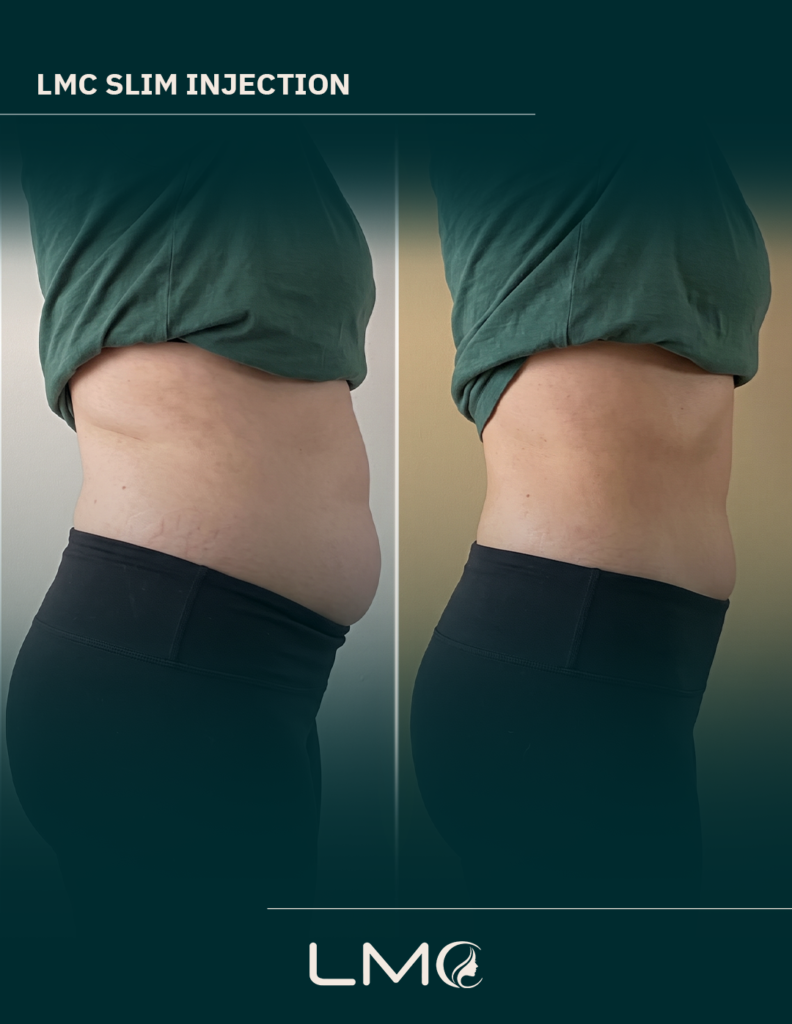 weight-loss-dubai-before-after-5