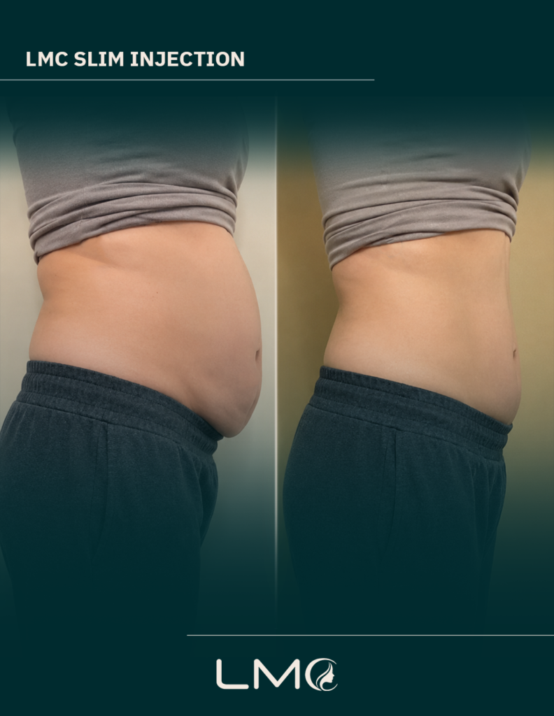 weight-loss-dubai-before-after-6